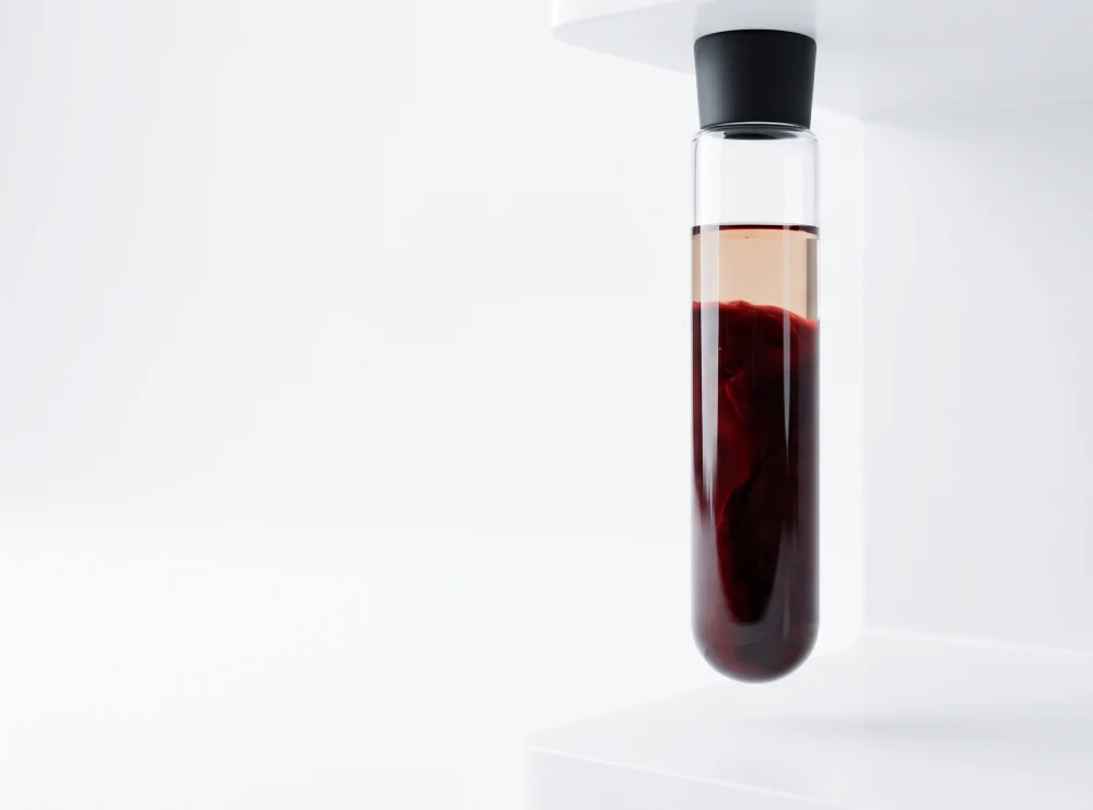 dickes-blut-aderlass-trt Dickes Blut - Aderlass hilft?!