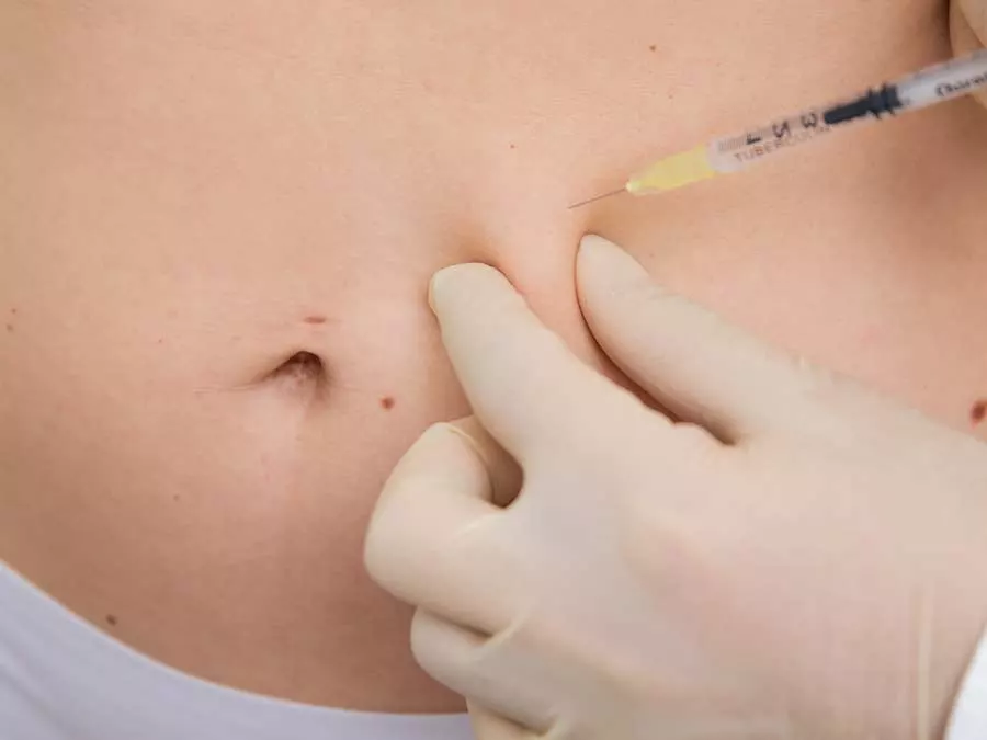 Fett-weg-Spritze in Duisburg