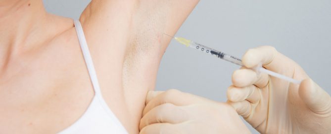 Hyperhidrose mit Botox in Duisburg behandeln