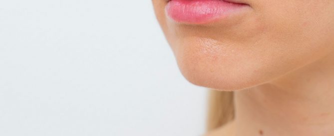 Lippenvergrößerung mit Hyaluronsäure in Duisburg