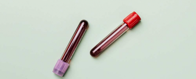 PRP Behandlung in Duisburg