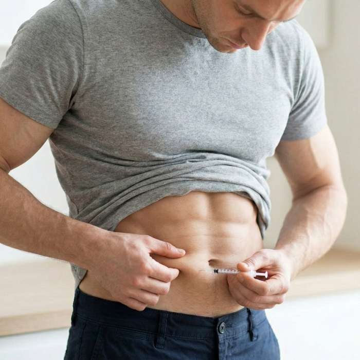 Verestertes Testosteron für die Testosteron-Ersatztherapie nahe Essen